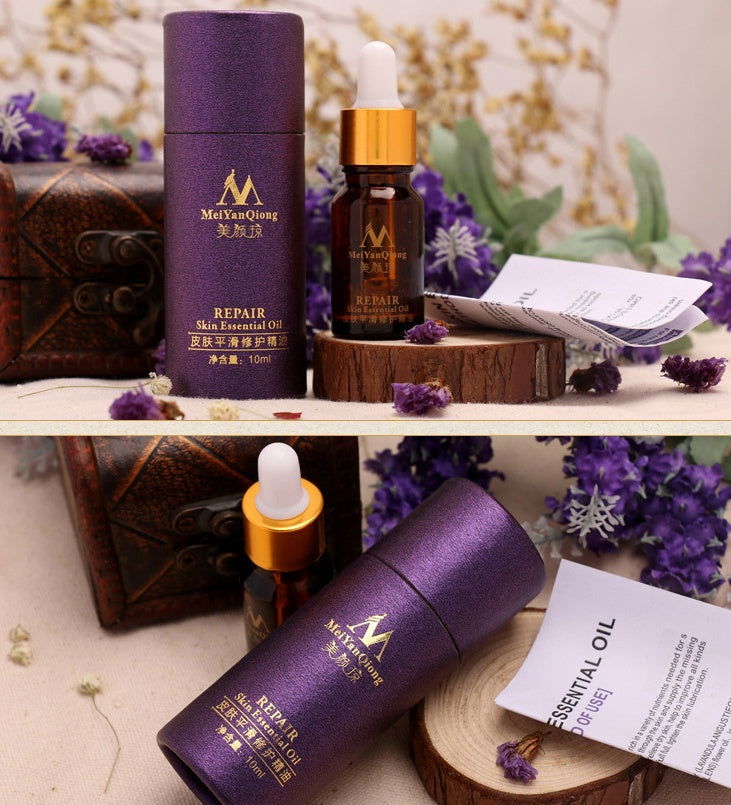 Scar Skin Repair Essential Oil Lavender Care Natural Skin Pure Remove Ance Burn Strentch Marks Removal Scar 10 ML - CHRISTDEST GLOBAL SERVICE